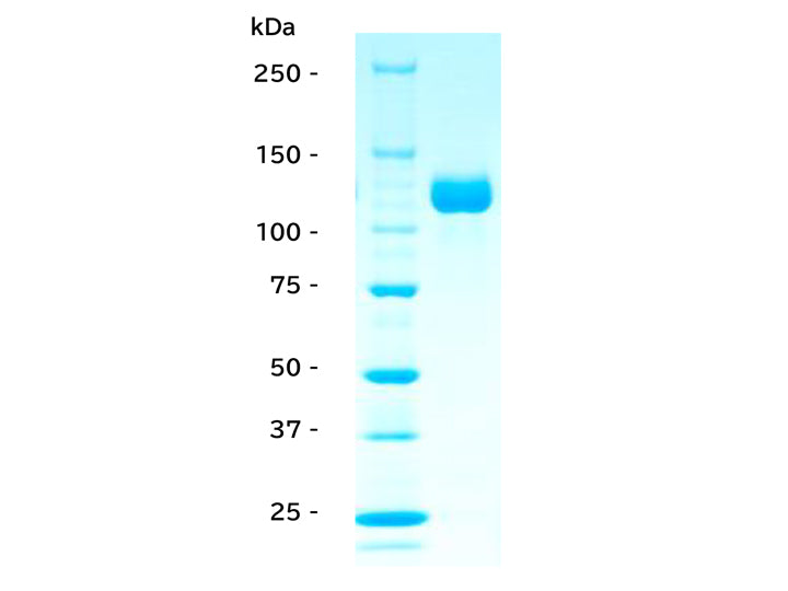 human ACE2 protein,<br/>mouse Fc tag<br/>[ RPC-007 ]