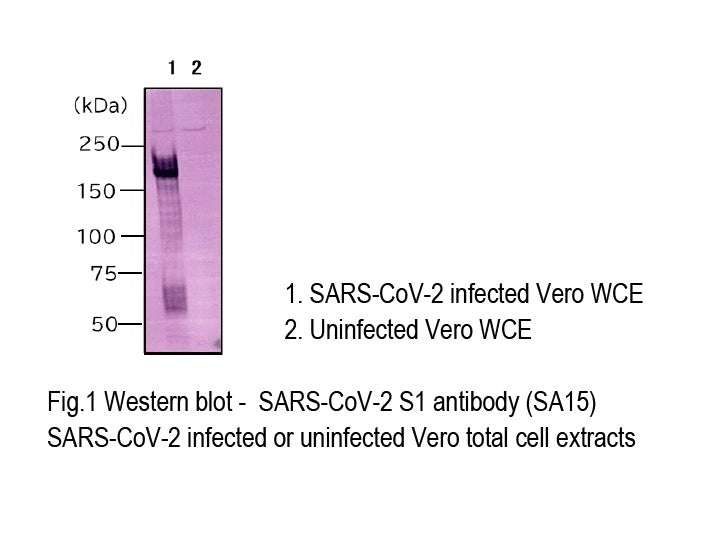 Anti-SARS-CoV-2 (2019-nCoV) /<br/>COVID-19 S1 rabbit mAb<br/>[Clone No.SA15]<br/>( SA15 )<br/>[ CEC-U008 ]