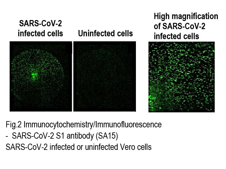 Anti-SARS-CoV-2 (2019-nCoV) /<br/>COVID-19 S1 rabbit mAb<br/>[Clone No.SA15]<br/>( SA15 )<br/>[ CEC-U008 ]