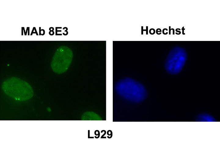 Anti-DHX9/RNA helicaseA mAb<br/>( 8E3 )<br/>[ CEC-042 ]