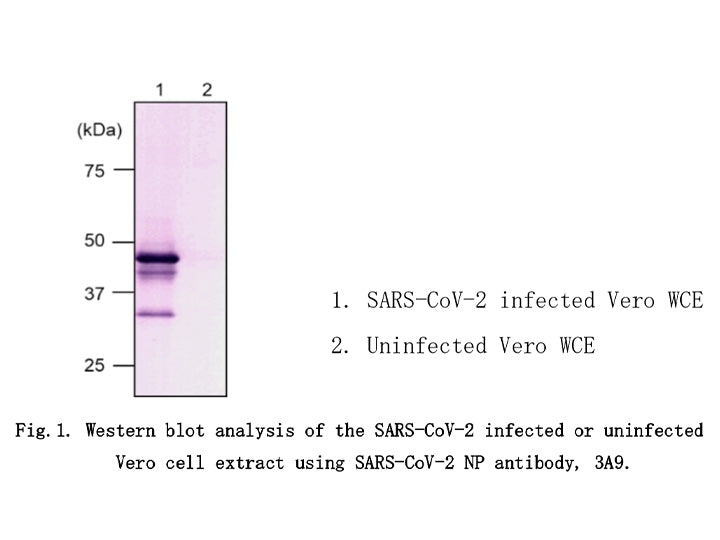 Anti-SARS-CoV-2 (2019-nCoV) /<br/>COVID-19 NP mAb<br/>[Clone No.3A9]<br/>( 3A9 )<br/>[ CEC-076 ]