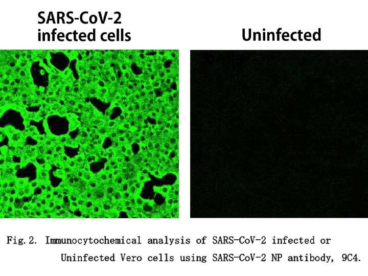 Anti-SARS-CoV-2 (2019-nCoV) /<br/>COVID-19 NP mAb<br/>[Clone No.9C4]<br/>( 9C4 )<br/>[ CEC-077 ]