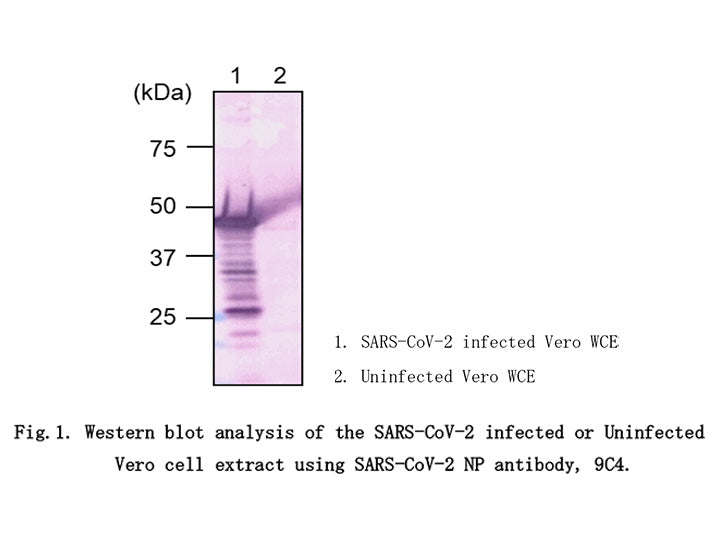 Anti-SARS-CoV-2 (2019-nCoV) /<br/>COVID-19 NP mAb<br/>[Clone No.9C4]<br/>( 9C4 )<br/>[ CEC-077 ]
