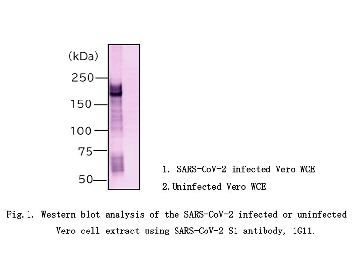 Anti-SARS-CoV-2 (2019-nCoV) /<br/>COVID-19 S1 mAb<br/>( 1G11 )<br/>[ CEC-078 ]