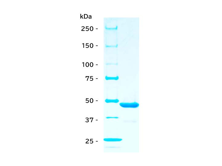 SARS-CoV-2 (2019-nCoV) /<br/>COVID-19 NP protein,<br/>6×His tag<br/>[ RPE-001 ]